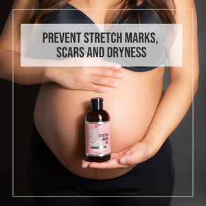 Pregnancy Stretch Mark Oil with Cocoa Butter and Almond Oil